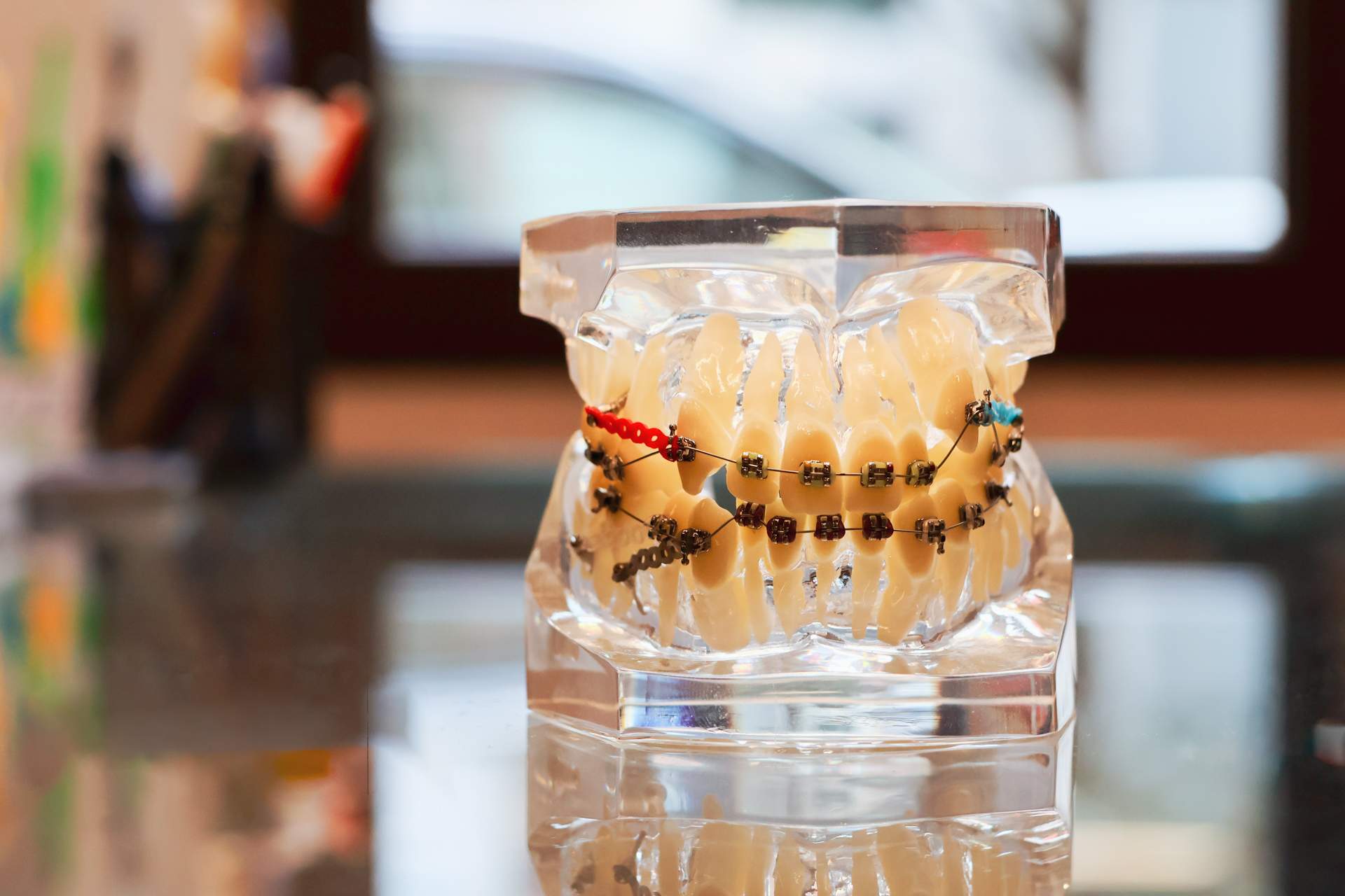 ortodoncia invisible en Gijón