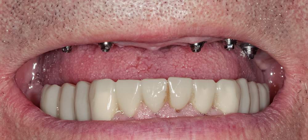 multiples-1 multiples-1