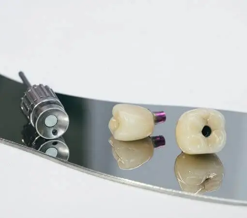 mejores coronas zirconio gijon