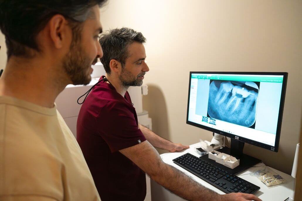 mejores-implantes-dentales-gijon