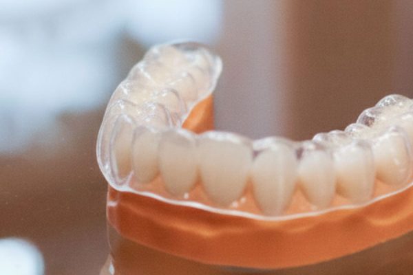 retenedores-io-cantabrico